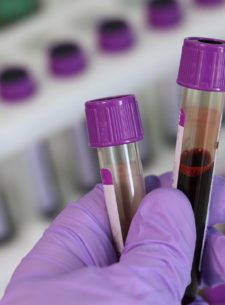 Sexually Transmitted Infections